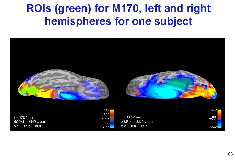 ROIs (green) for M 170, left and right hemispheres for one subject 66 