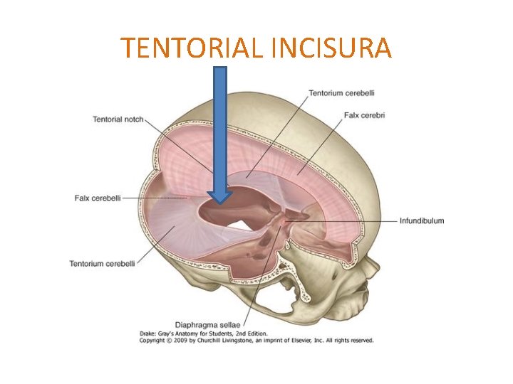 TENTORIAL INCISURA 