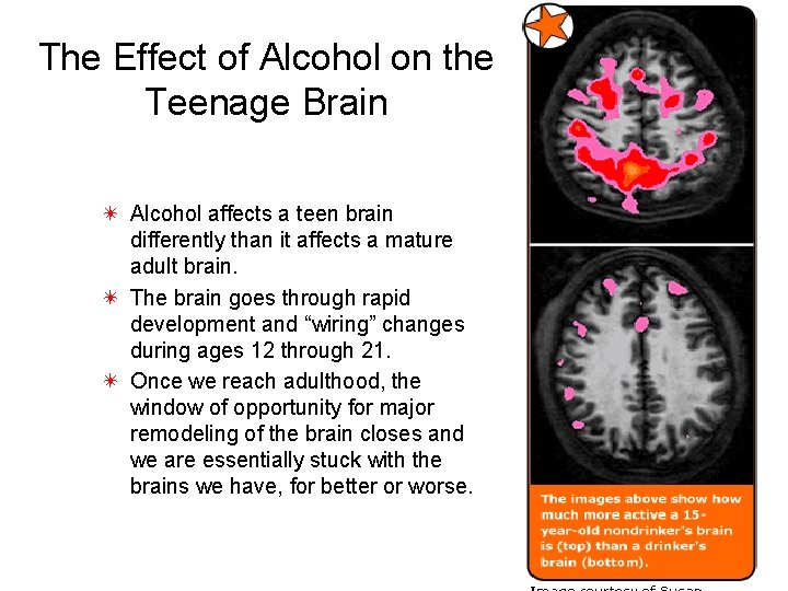 The Effect of Alcohol on the Teenage Brain ✴ Alcohol affects a teen brain