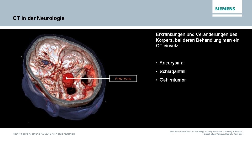CT in der Neurologie Erkrankungen und Veränderungen des Körpers, bei deren Behandlung man ein