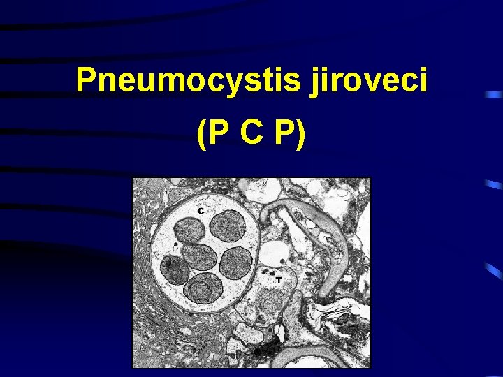 Pneumocystis jiroveci (P C P) 