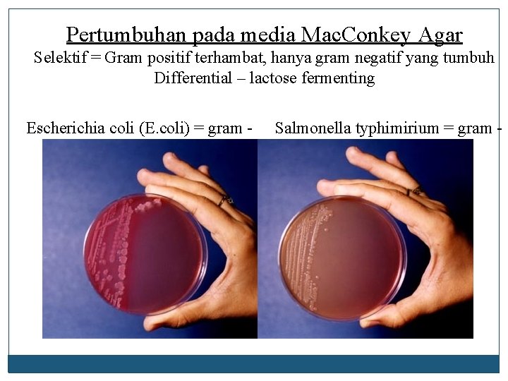 Pertumbuhan pada media Mac. Conkey Agar Selektif = Gram positif terhambat, hanya gram negatif