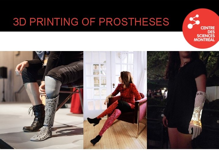 3 D PRINTING OF PROSTHESES 