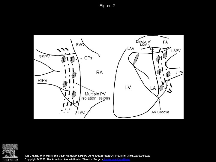 Figure 2 The Journal of Thoracic and Cardiovascular Surgery 2010 139326 -332 DOI: (10.