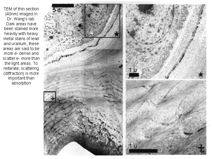 TEM of thin section (40 nm) imaged in Dr. Wang’s lab. Dark areas have