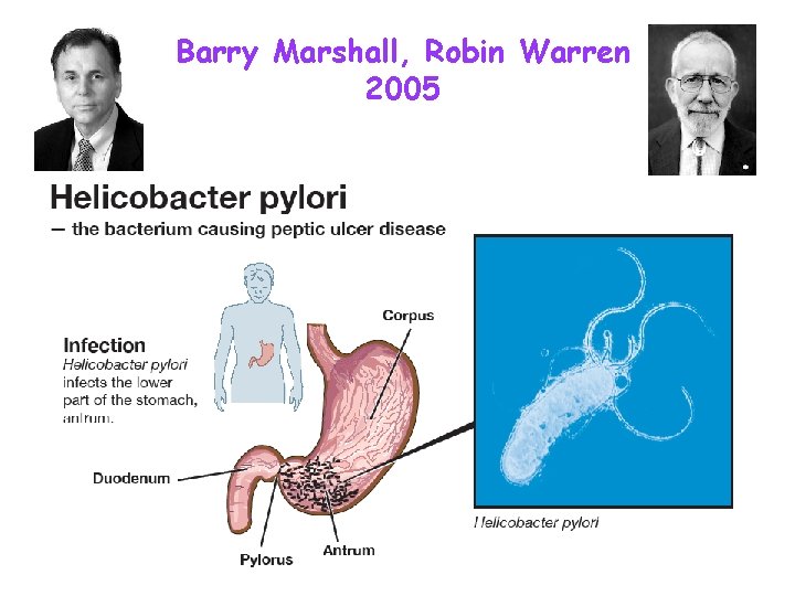 Barry Marshall, Robin Warren 2005 