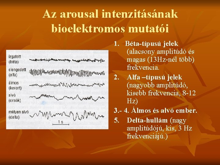 Az arousal intenzitásának bioelektromos mutatói 1. Béta-típusú jelek (alacsony amplitúdó és magas (13 Hz-nél