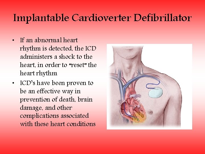 Implantable Cardioverter Defibrillator • If an abnormal heart rhythm is detected, the ICD administers