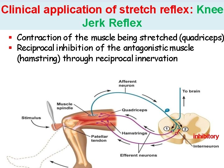 Clinical application of stretch reflex: Knee Jerk Reflex Contraction of the muscle being stretched