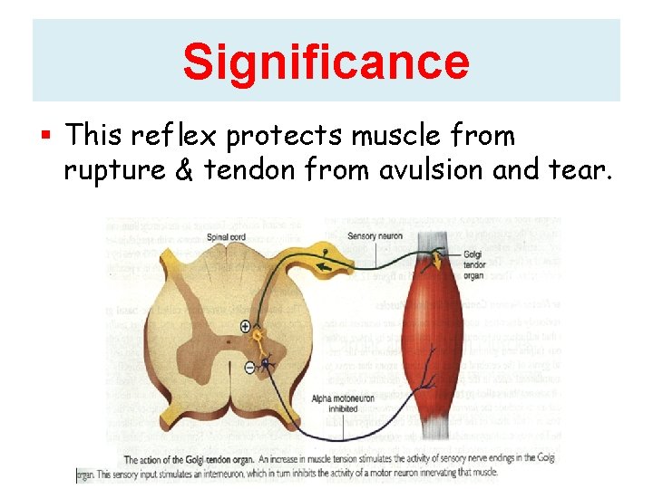 Significance This reflex protects muscle from rupture & tendon from avulsion and tear. Significance This reflex protects muscle from rupture & tendon from avulsion and tear.