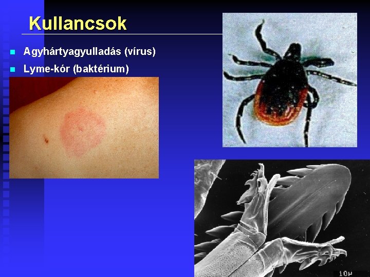 Kullancsok n Agyhártyagyulladás (vírus) n Lyme-kór (baktérium) 