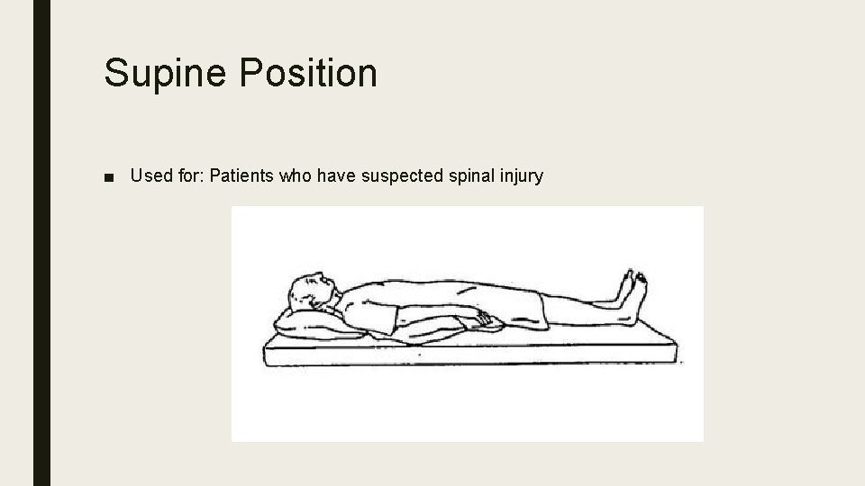 Supine Position ■ Used for: Patients who have suspected spinal injury 