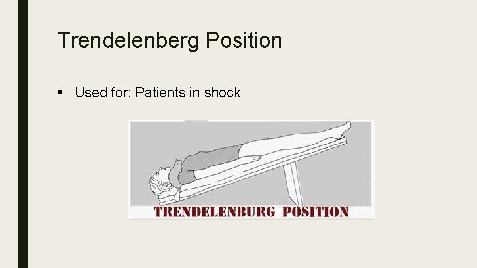 Trendelenberg Position § Used for: Patients in shock 