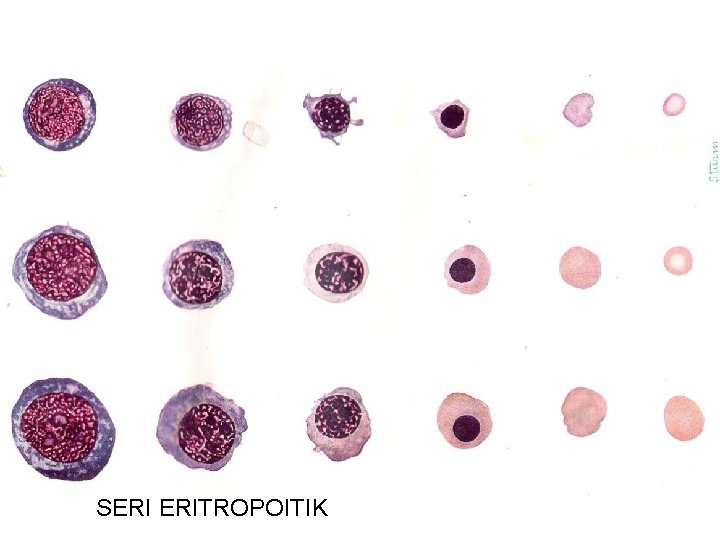 SERI ERITROPOITIK 