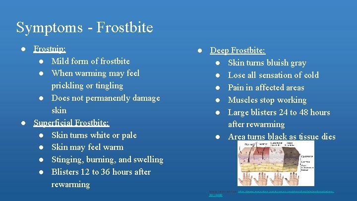 Symptoms - Frostbite ● Frostnip: ● Mild form of frostbite ● When warming may