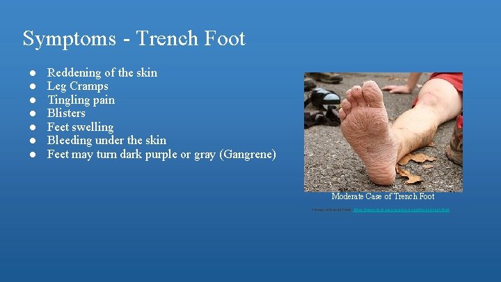 Symptoms - Trench Foot ● ● ● ● Reddening of the skin Leg Cramps