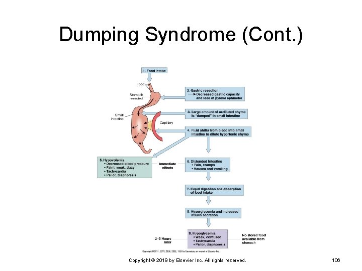 Dumping Syndrome (Cont. ) Copyright © 2019 by Elsevier Inc. All rights reserved. 106
