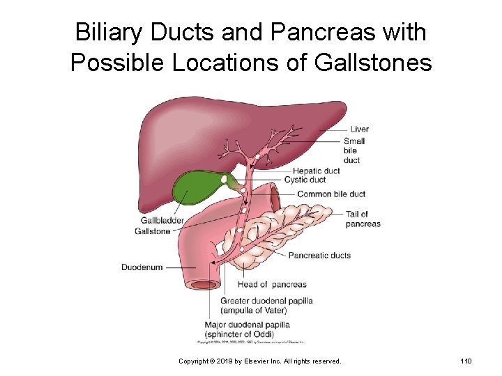 Biliary Ducts and Pancreas with Possible Locations of Gallstones Copyright © 2019 by Elsevier
