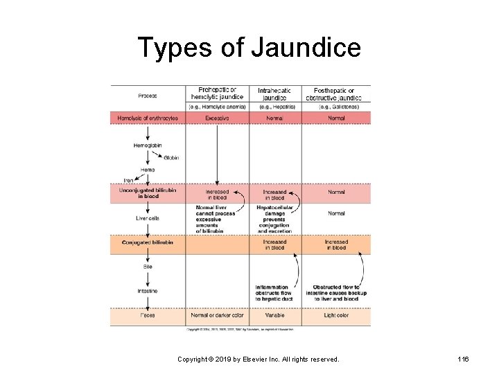 Types of Jaundice Copyright © 2019 by Elsevier Inc. All rights reserved. 116 