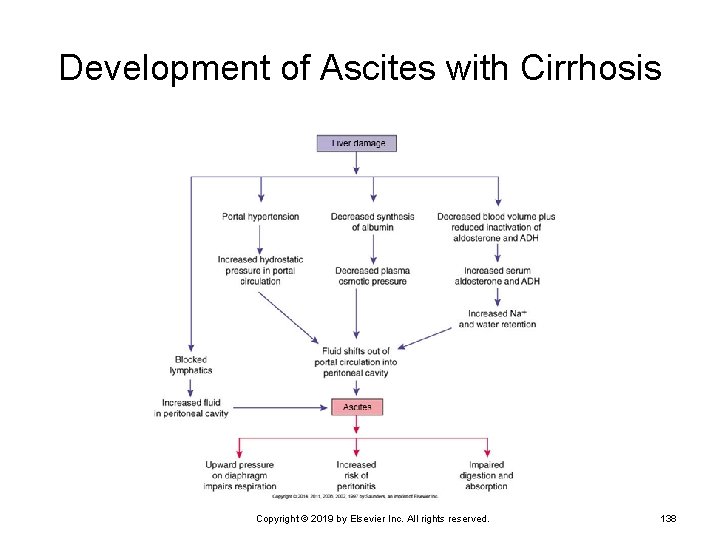 Development of Ascites with Cirrhosis Copyright © 2019 by Elsevier Inc. All rights reserved.