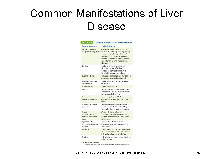 Common Manifestations of Liver Disease Copyright © 2019 by Elsevier Inc. All rights reserved.