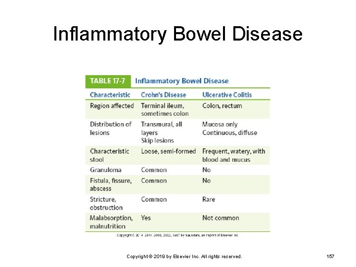 Inflammatory Bowel Disease Copyright © 2019 by Elsevier Inc. All rights reserved. 157 