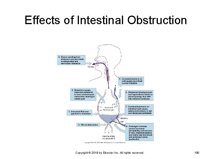 Effects of Intestinal Obstruction Copyright © 2019 by Elsevier Inc. All rights reserved. 190