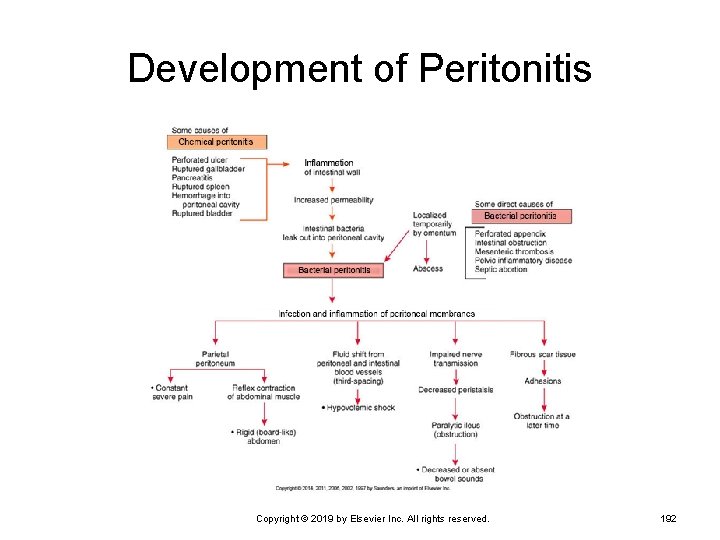 Development of Peritonitis Copyright © 2019 by Elsevier Inc. All rights reserved. 192 