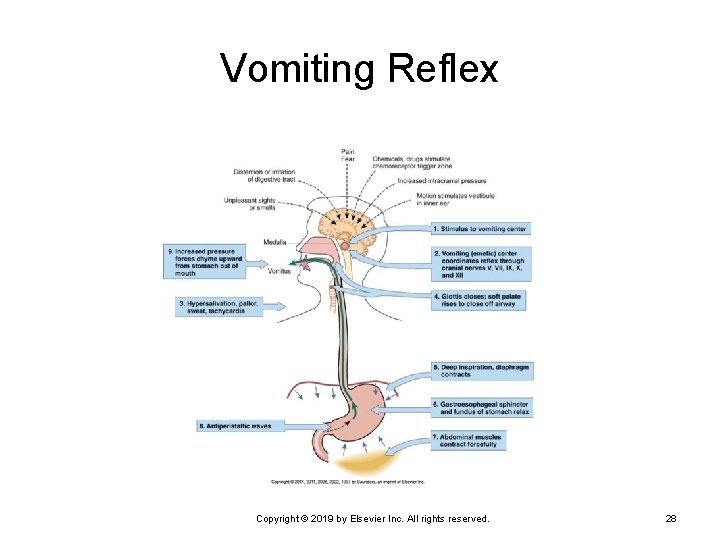 Vomiting Reflex Copyright © 2019 by Elsevier Inc. All rights reserved. 28 