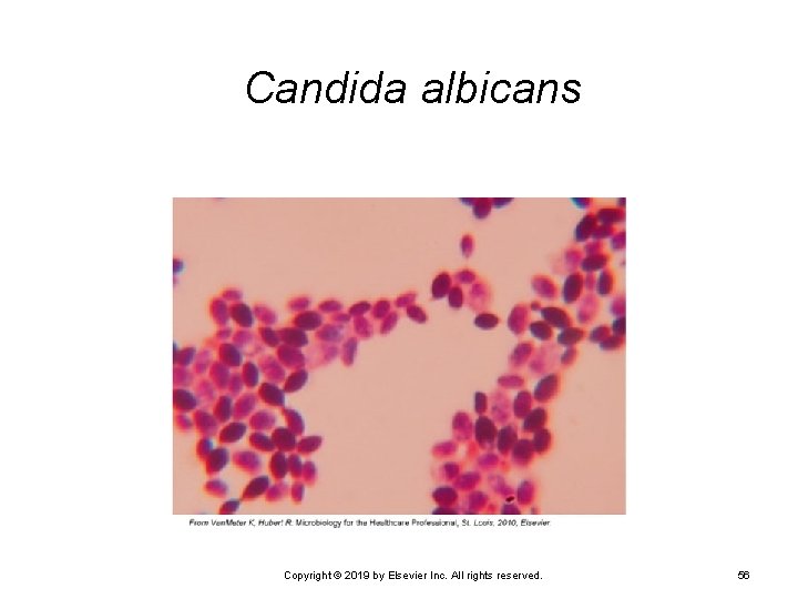 Candida albicans Copyright © 2019 by Elsevier Inc. All rights reserved. 56 