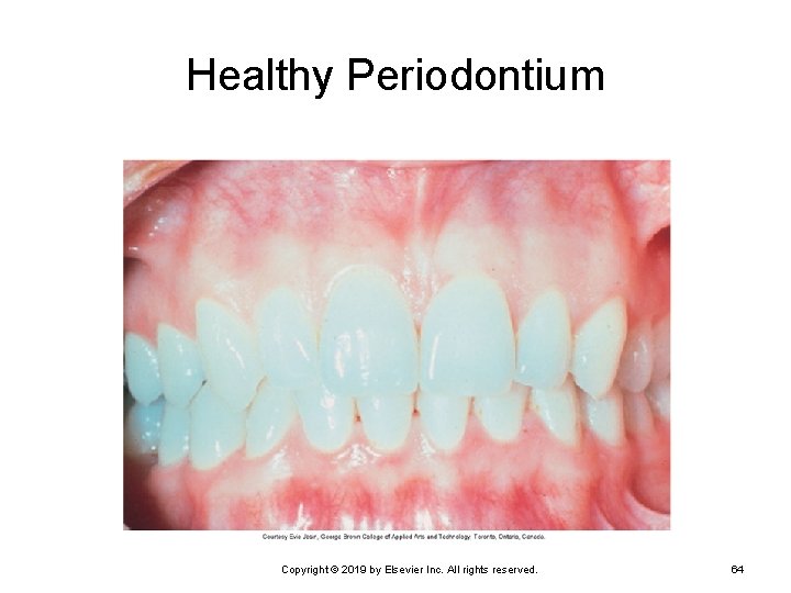 Healthy Periodontium Copyright © 2019 by Elsevier Inc. All rights reserved. 64 