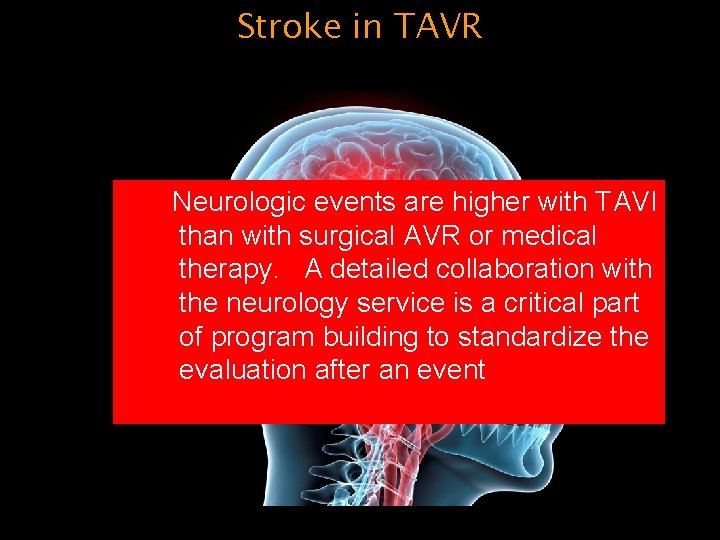 Stroke in TAVR Neurologic events are higher with TAVI than with surgical AVR or