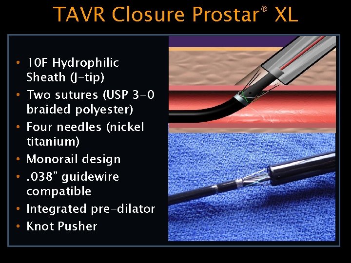 TAVR Closure Prostar® XL • 10 F Hydrophilic Sheath (J-tip) • Two sutures (USP