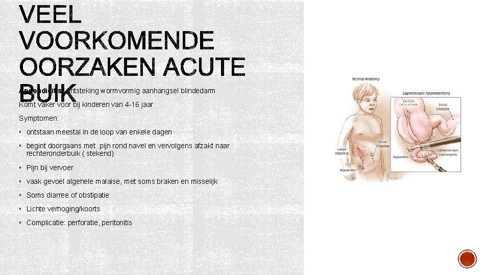 Appendicitis: ontsteking wormvormig aanhangsel blindedarm Komt vaker voor bij kinderen van 4 -16 jaar