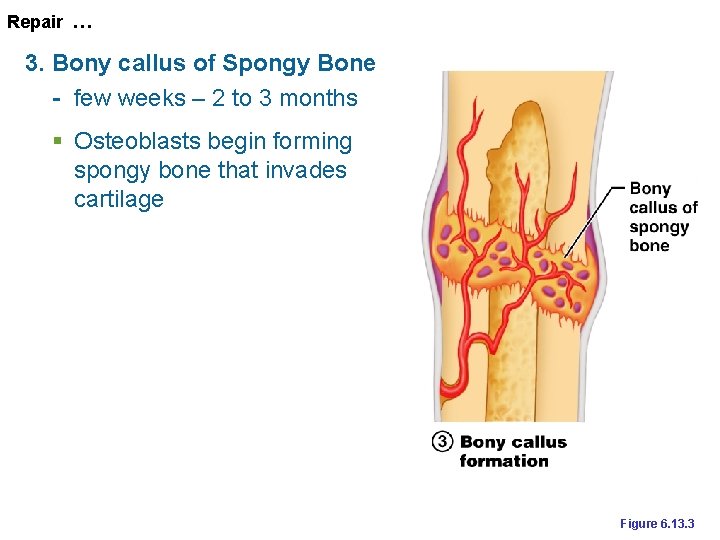 Repair … 3. Bony callus of Spongy Bone - few weeks – 2 to