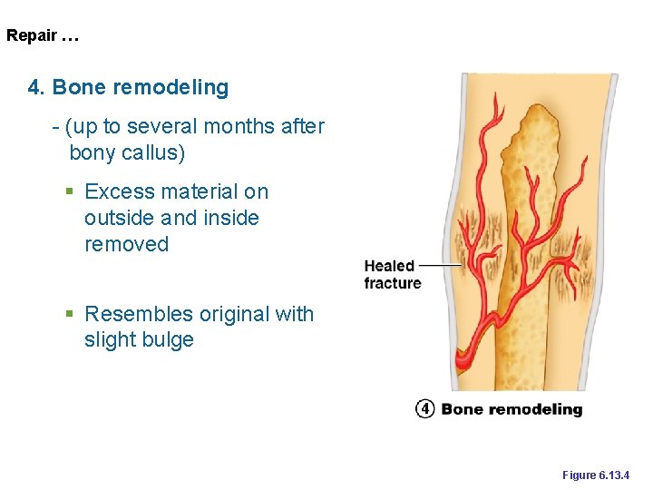 Repair … 4. Bone remodeling - (up to several months after bony callus) §