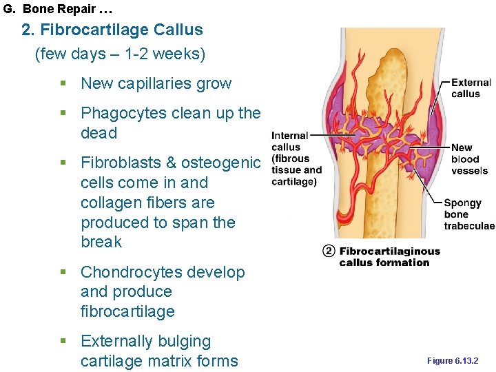 G. Bone Repair … 2. Fibrocartilage Callus (few days – 1 -2 weeks) §