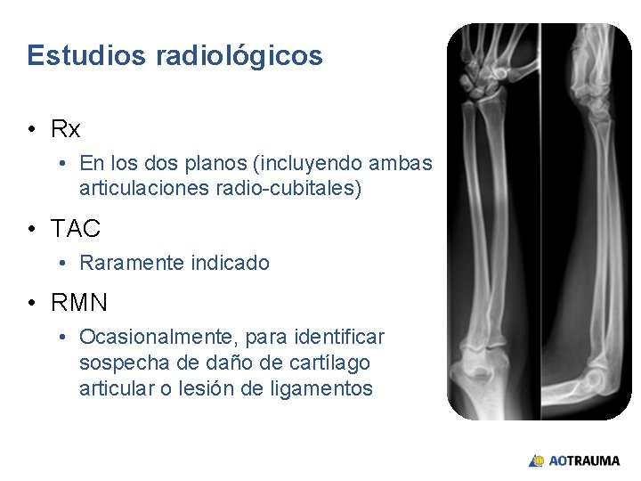 Estudios radiológicos • Rx • En los dos planos (incluyendo ambas articulaciones radio-cubitales) •