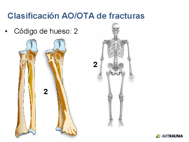 Clasificación AO/OTA de fracturas • Código de hueso: 2 2 2 
