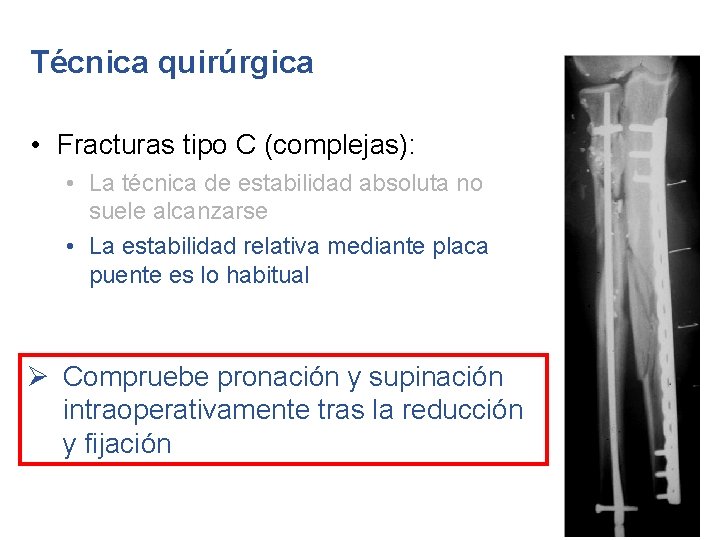Técnica quirúrgica • Fracturas tipo C (complejas): • La técnica de estabilidad absoluta no