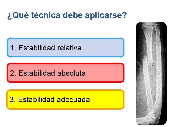 ¿Qué técnica debe aplicarse? 1. Estabilidad relativa 2. Estabilidad absoluta 3. Estabilidad adecuada 