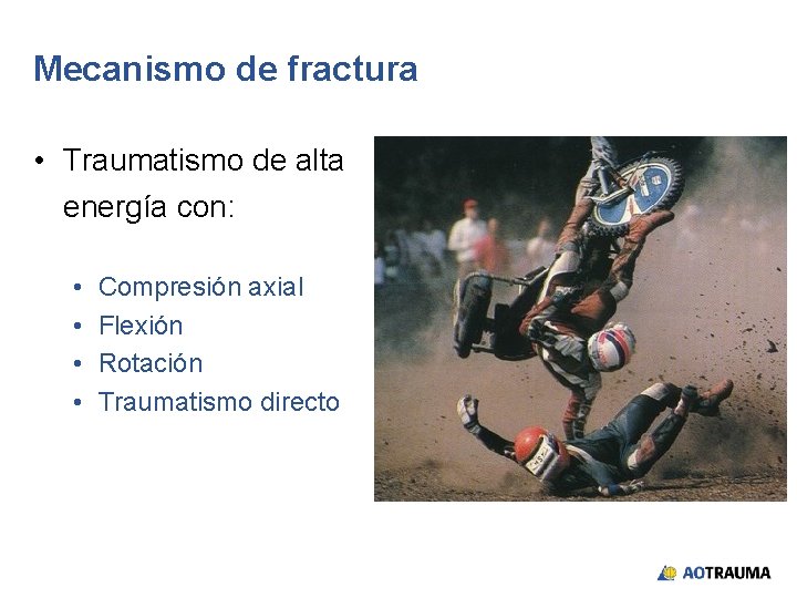 Mecanismo de fractura • Traumatismo de alta energía con: • • Compresión axial Flexión
