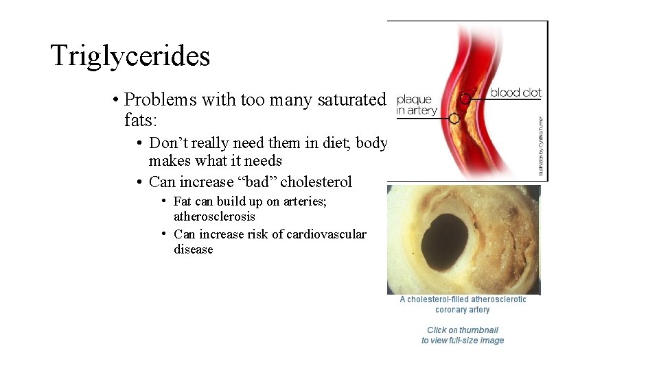 Triglycerides • Problems with too many saturated fats: • Don’t really need them in