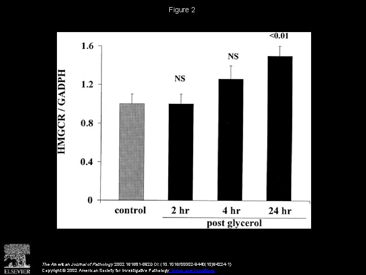 Figure 2 The American Journal of Pathology 2002 161681 -692 DOI: (10. 1016/S 0002