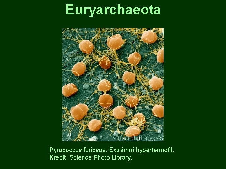 Euryarchaeota Pyrococcus furiosus. Extrémní hypertermofil. Kredit: Science Photo Library. 