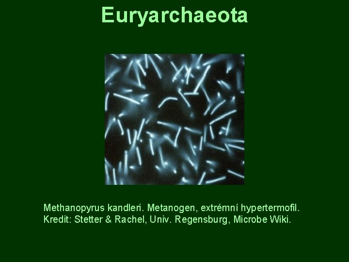 Euryarchaeota Methanopyrus kandleri. Metanogen, extrémní hypertermofil. Kredit: Stetter & Rachel, Univ. Regensburg, Microbe Wiki.