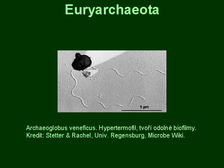 Euryarchaeota Archaeoglobus veneficus. Hypertermofil, tvoří odolné biofilmy. Kredit: Stetter & Rachel, Univ. Regensburg, Microbe