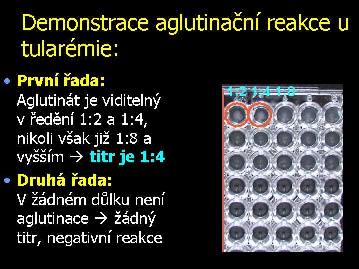 Demonstrace aglutinační reakce u tularémie: • První řada: Aglutinát je viditelný v ředění 1: