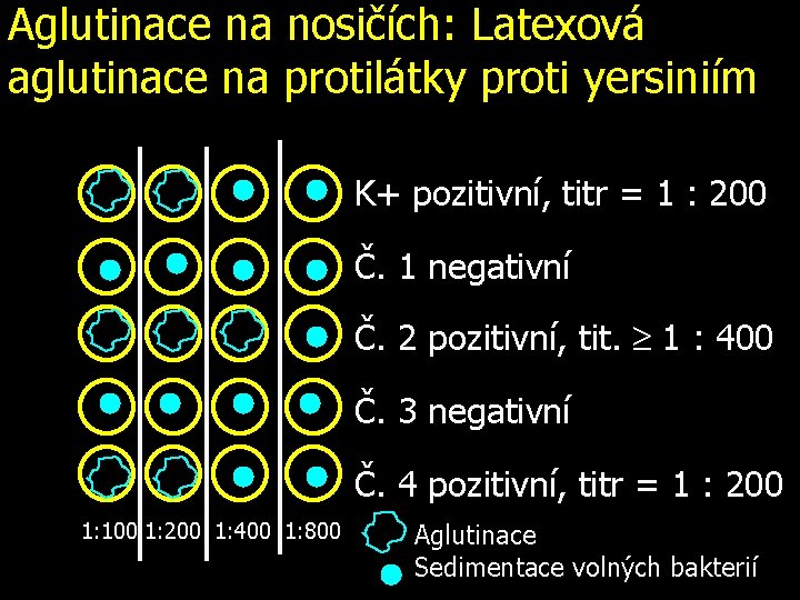 Aglutinace na nosičích: Latexová aglutinace na protilátky proti yersiniím K+ pozitivní, titr = 1