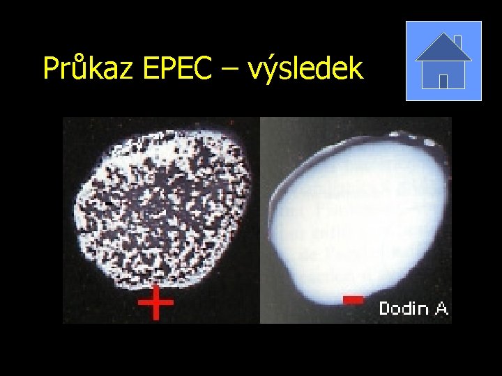 Průkaz EPEC – výsledek 